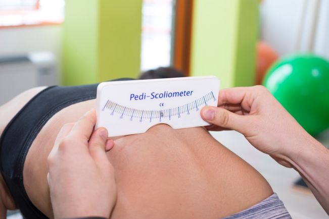 Scoliosis Screening with Pedi-Scoliometer on young person spine